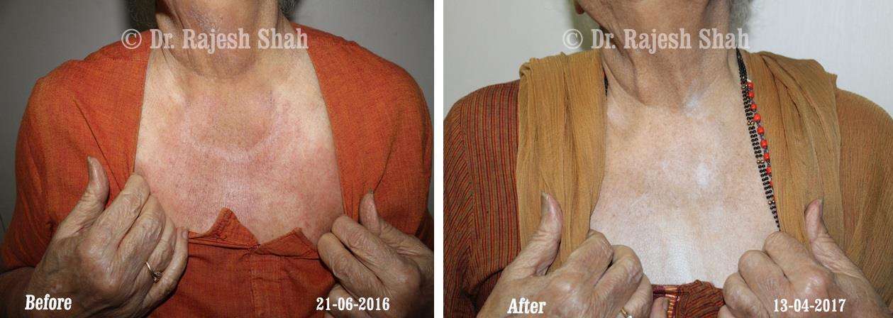 lifeforce homeopathy case-photos